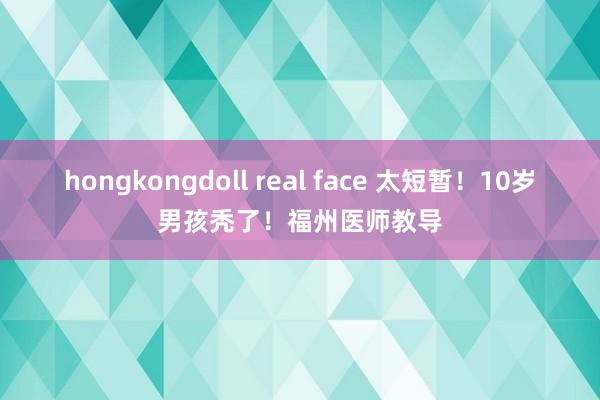 hongkongdoll real face 太短暂！10岁男孩秃了！福州医师教导